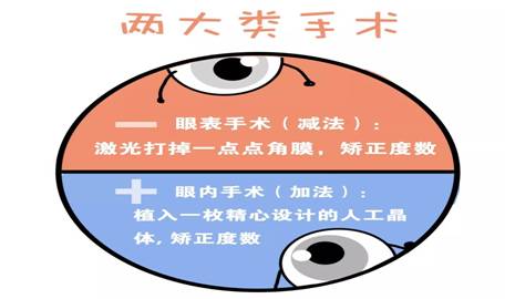 最新近視矯正技術(shù),最新近視矯正技術(shù)，重塑清晰視界