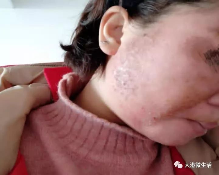 最新寶顏術(shù)，探索美容新境界的奧秘